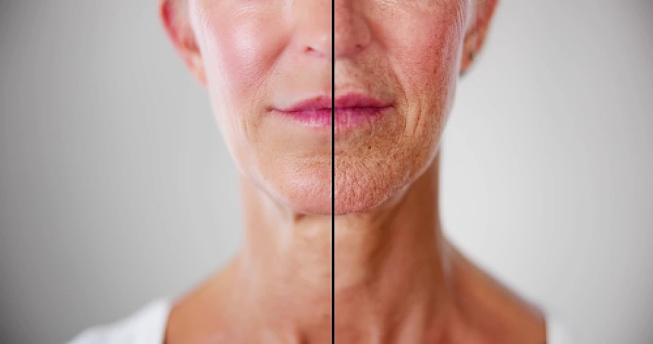 2 Skin Aging Reversal Remedies Proven Clinically