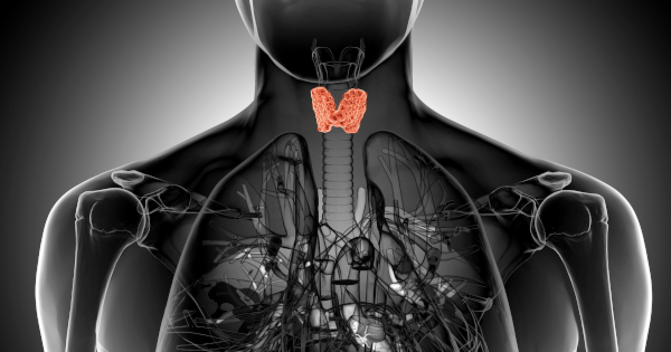 The Gluten-Free Effect: How Diet Impacts Thyroid Antibodies in Hashimoto's