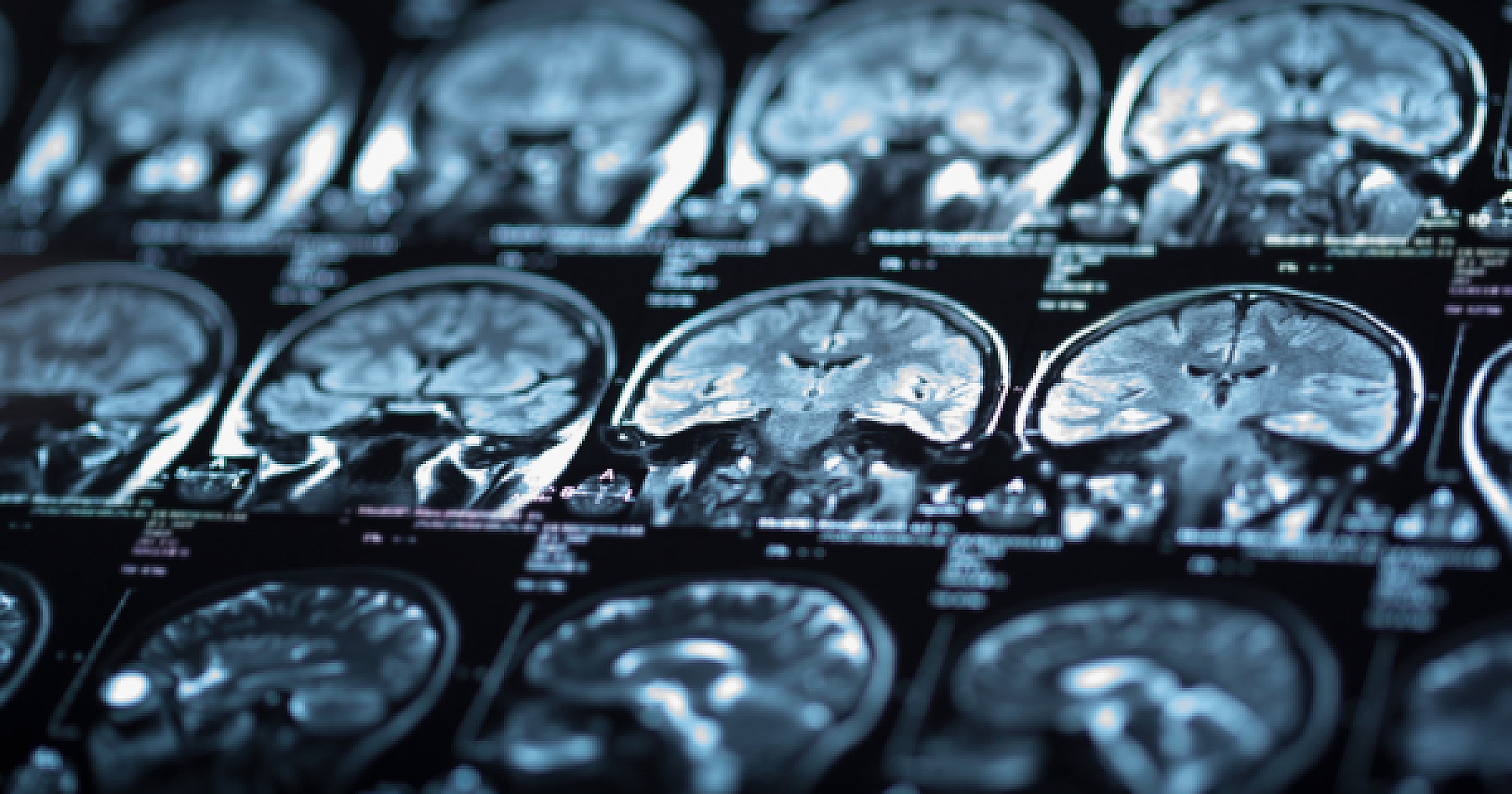 The Unintended Consequences of "Miracle" Growth Hormone Treatments