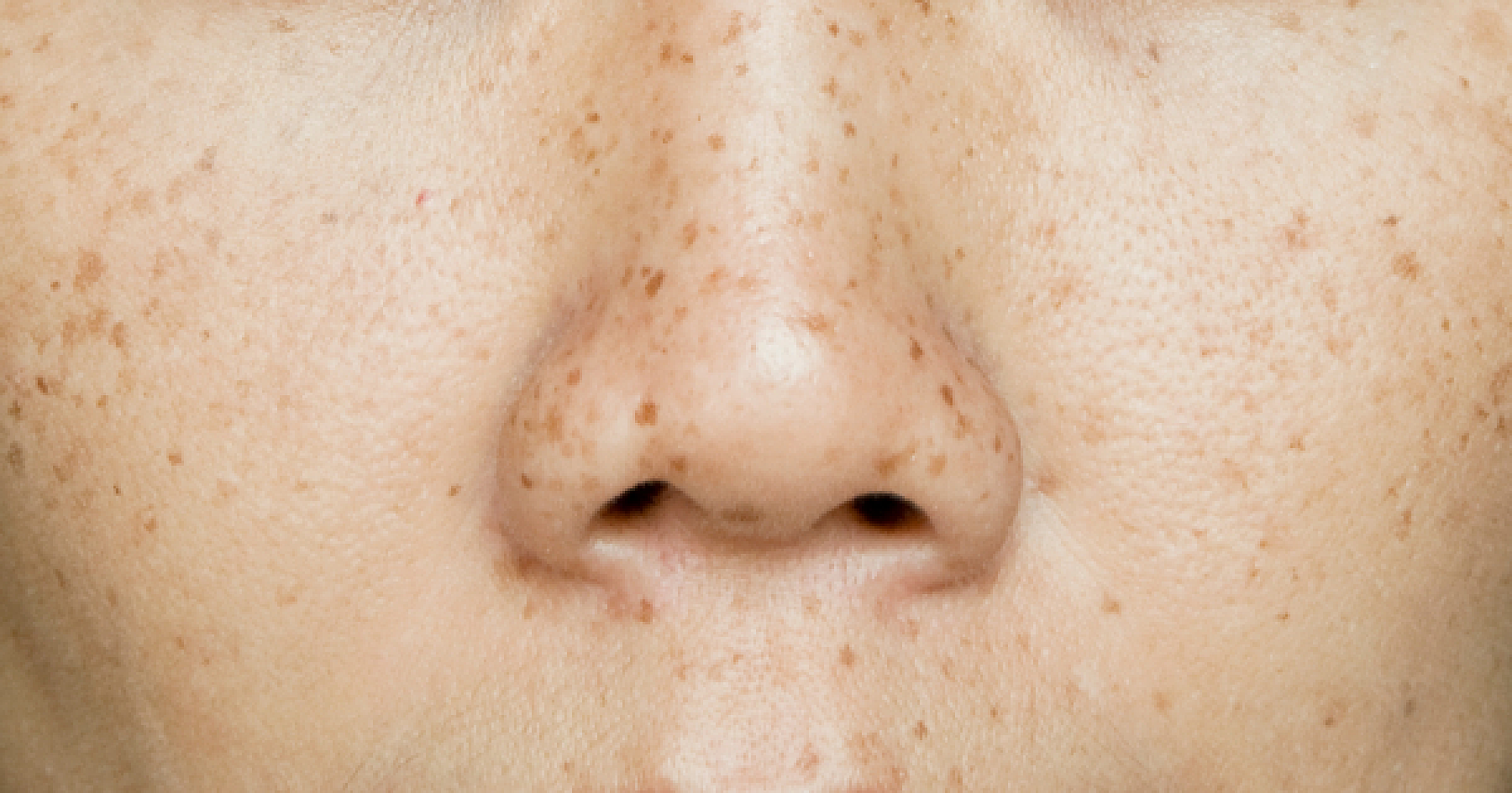 Open Your Mind, Close Your Mouth: Oral Breathing Impedes Optimal Brain Activity
