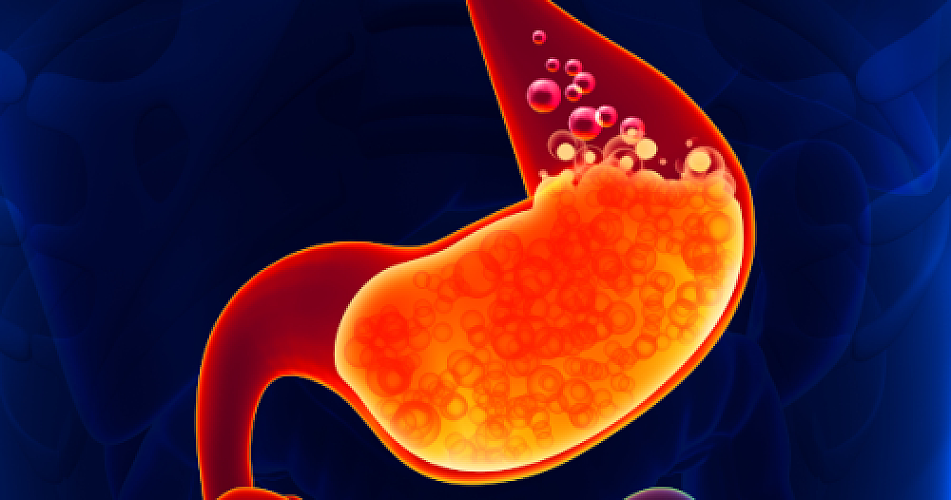 Proton Pump Inhibitors Linked to Increased Gastric Cancer Risk