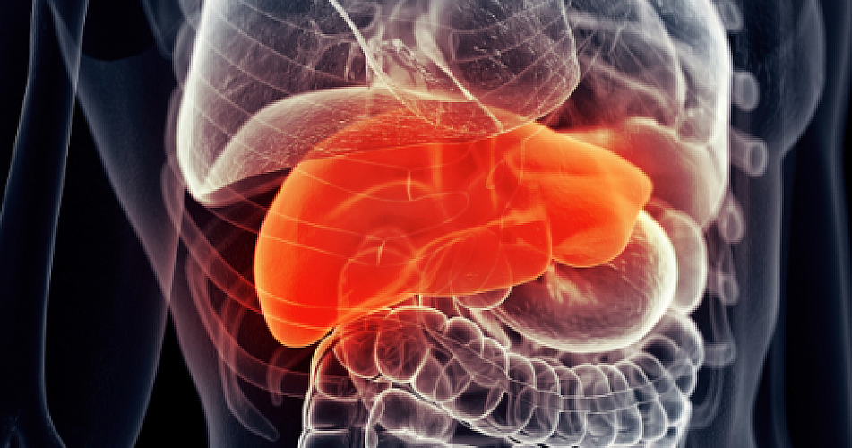 Tackling the NAFLD Epidemic: Milk Thistle & Many Other Natural Substances Offer Hope