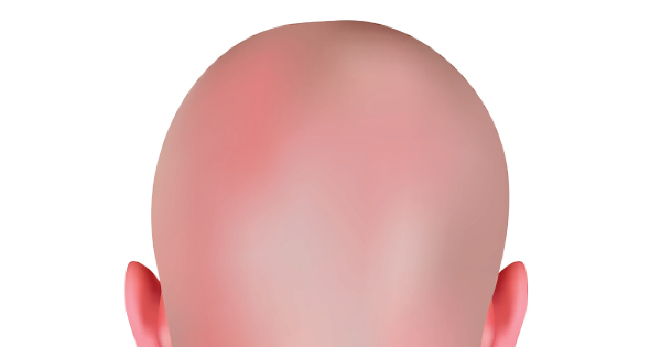 Hair Today, Sex Gone Tomorrow: The Finasteride Fallout and 10 Natural Solutions