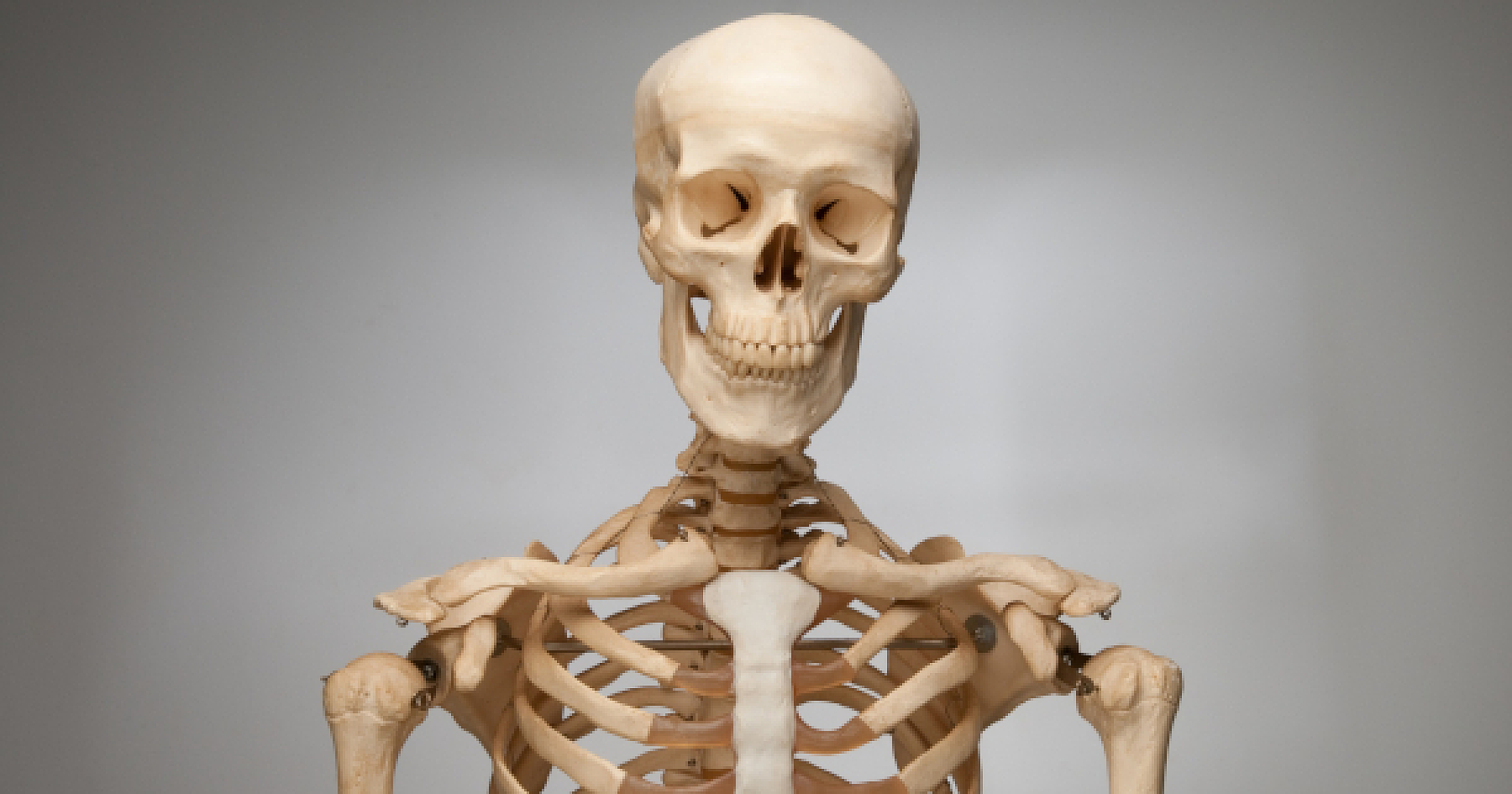 Nutritional Deficiencies Linked to Rare Bone Disorder: New Hope from Selenium and Iodine