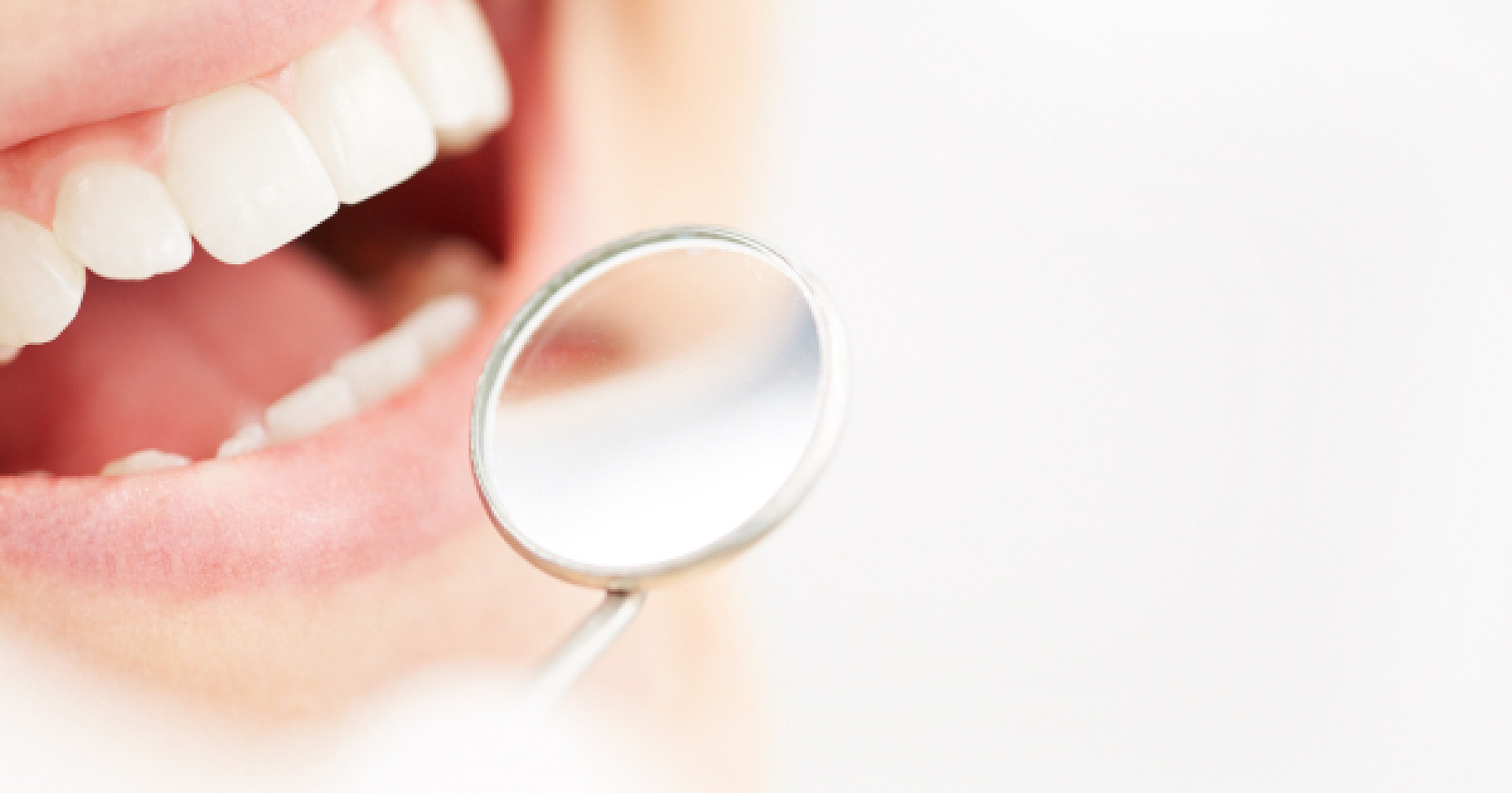 New Hope for Oral Lichen Planus Sufferers: Vitamin D and Beyond