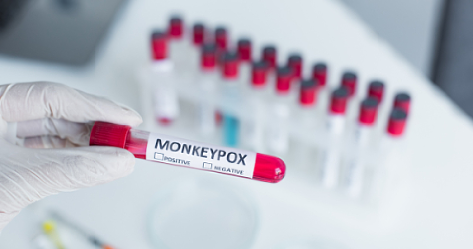 Pandemic Profits: Analyzing the Market Response to WHO's Monkeypox Alert