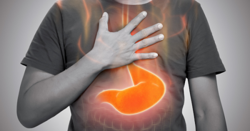 Homemade Remedies for GERD: Boosting Acidophilus Naturally for Acid Reflux Relief
