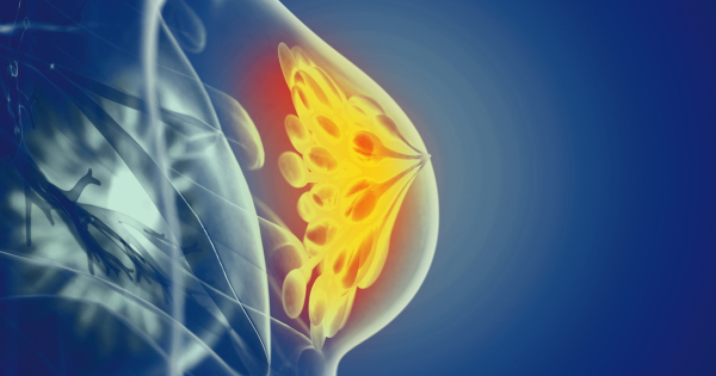 Is DCIS Being Overtreated in Elderly Women?