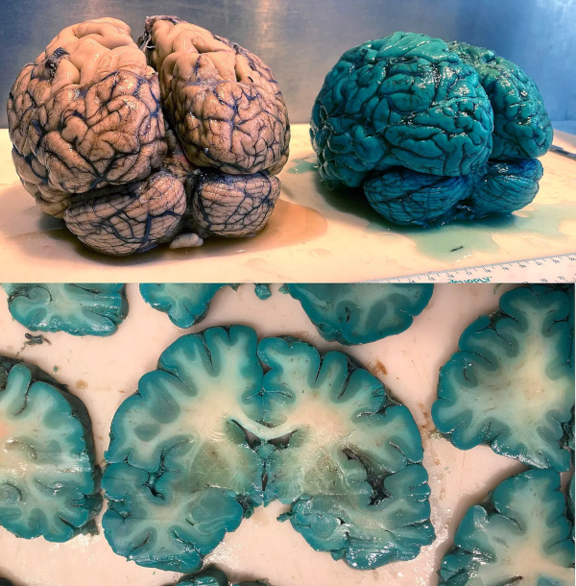 The Blue Brain Effect: Methylene Blue's Dark Side & What You Should Be Using Instead