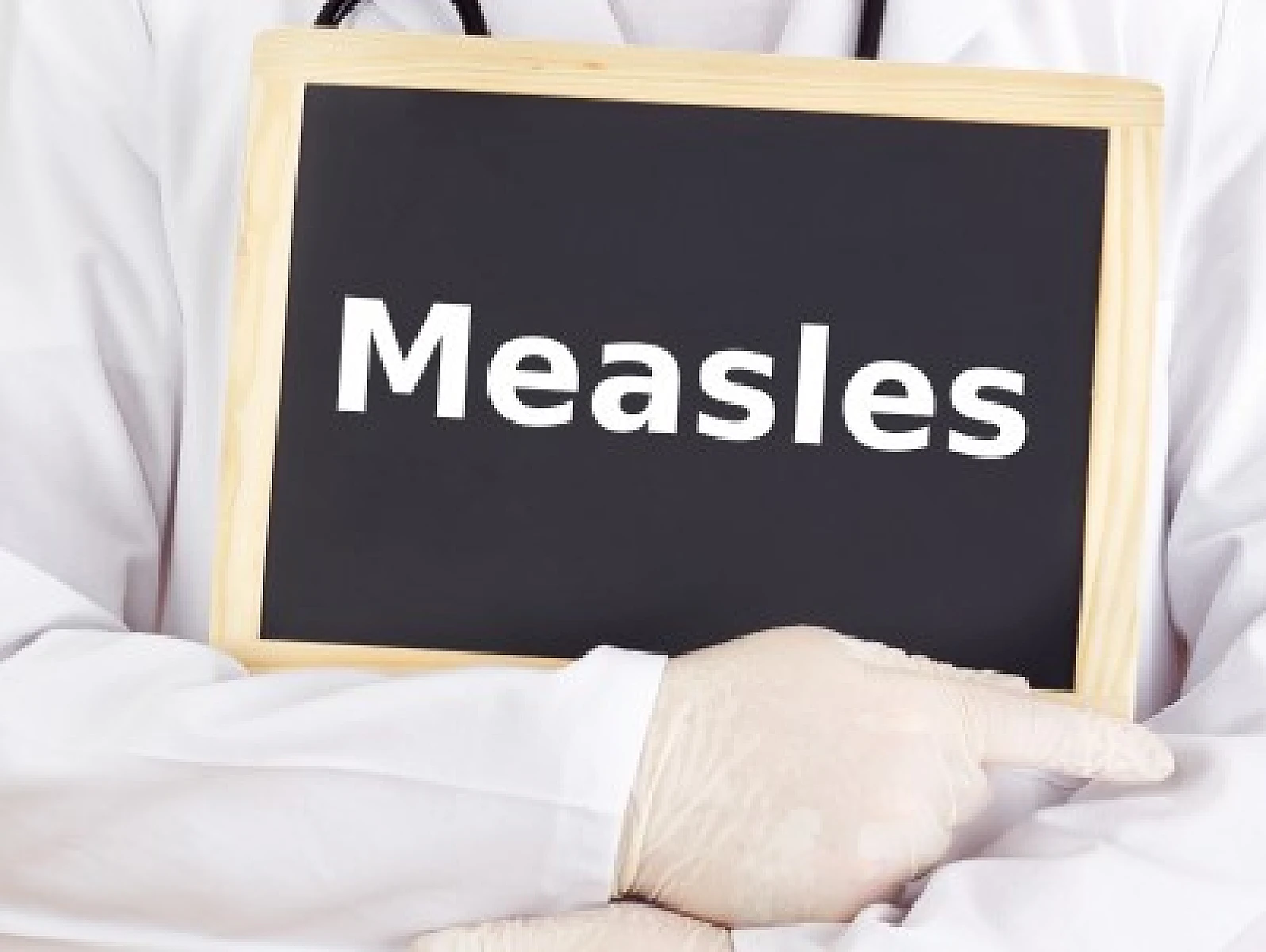 Measles: A Rash of Misinformation