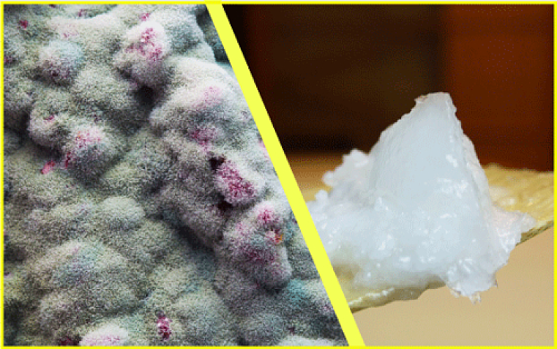 The Antifungal You're Not Hearing About: Coconut Oil's Evidence-Based Power Against Candida