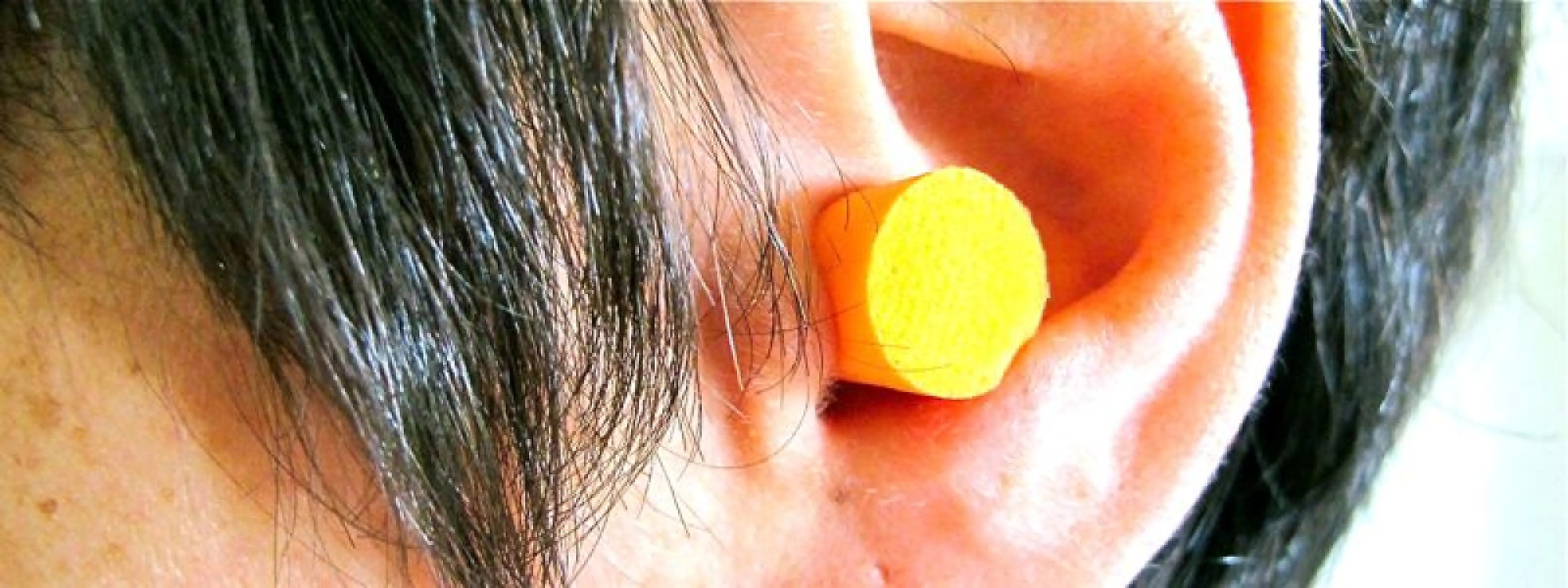 Acupuncture is Silence on Crack
