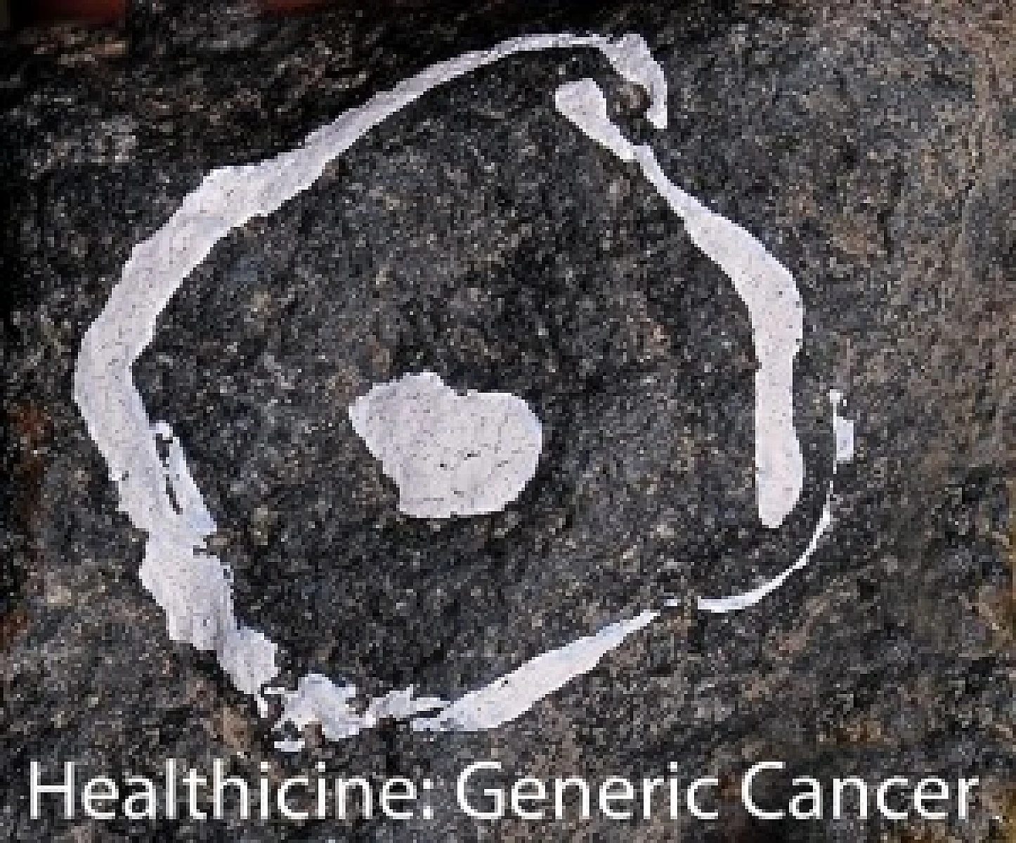 Generic Cancer Part 1: What is Generic Cancer, Does Generic Cancer Kill?