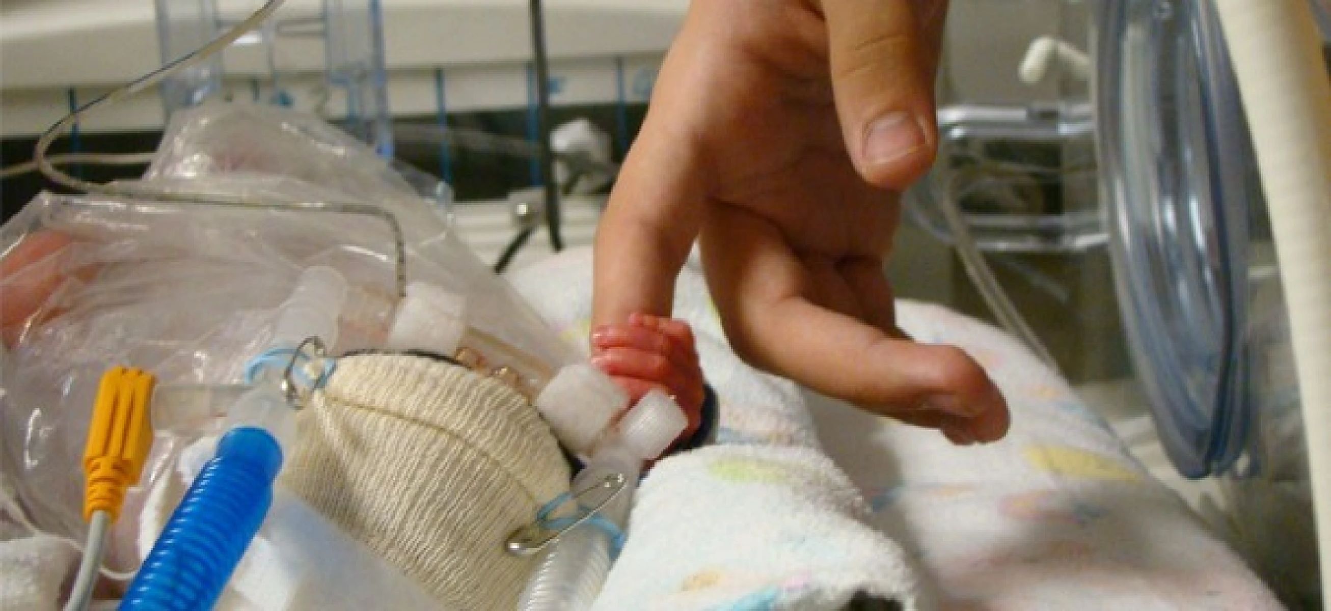 Failing Our Weakest Newborns: Poisoning with Aluminum