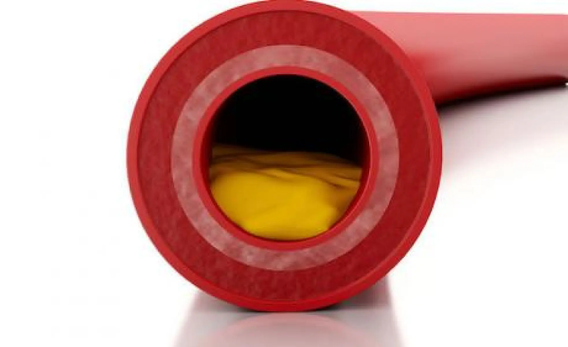 Research: Garlic Supplement Slows Cardiovascular Disease Progression, Decalcifies Arteries