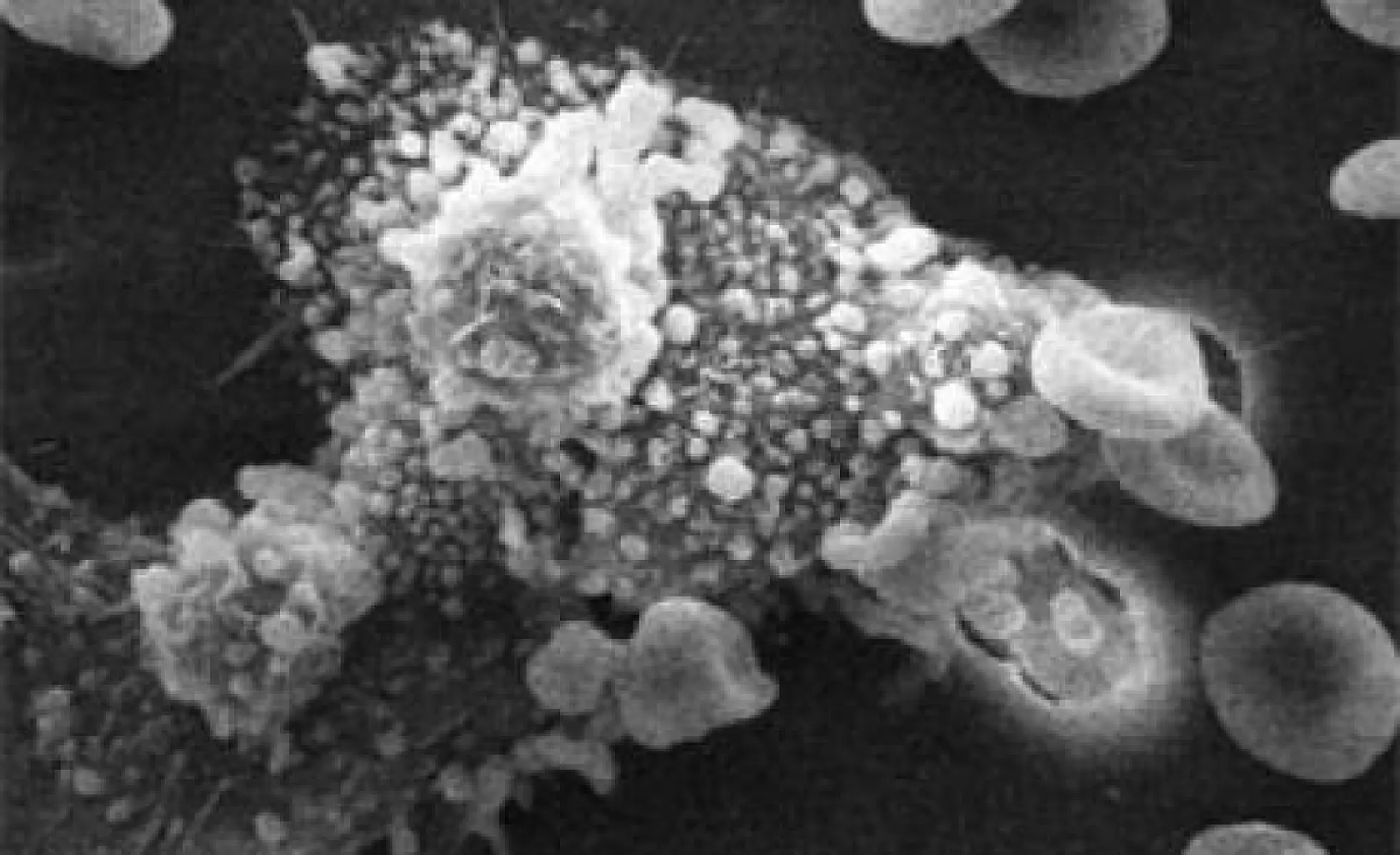 The Cure for Cancer Begins With Understanding It