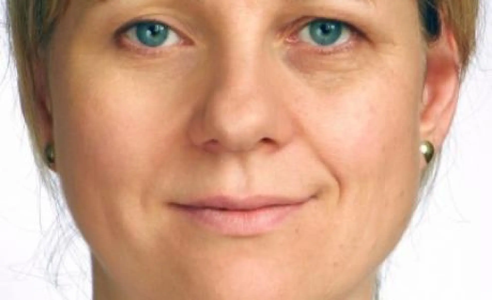 Skin Age Reversed 13 Years In Just 9 Months By Doing This
