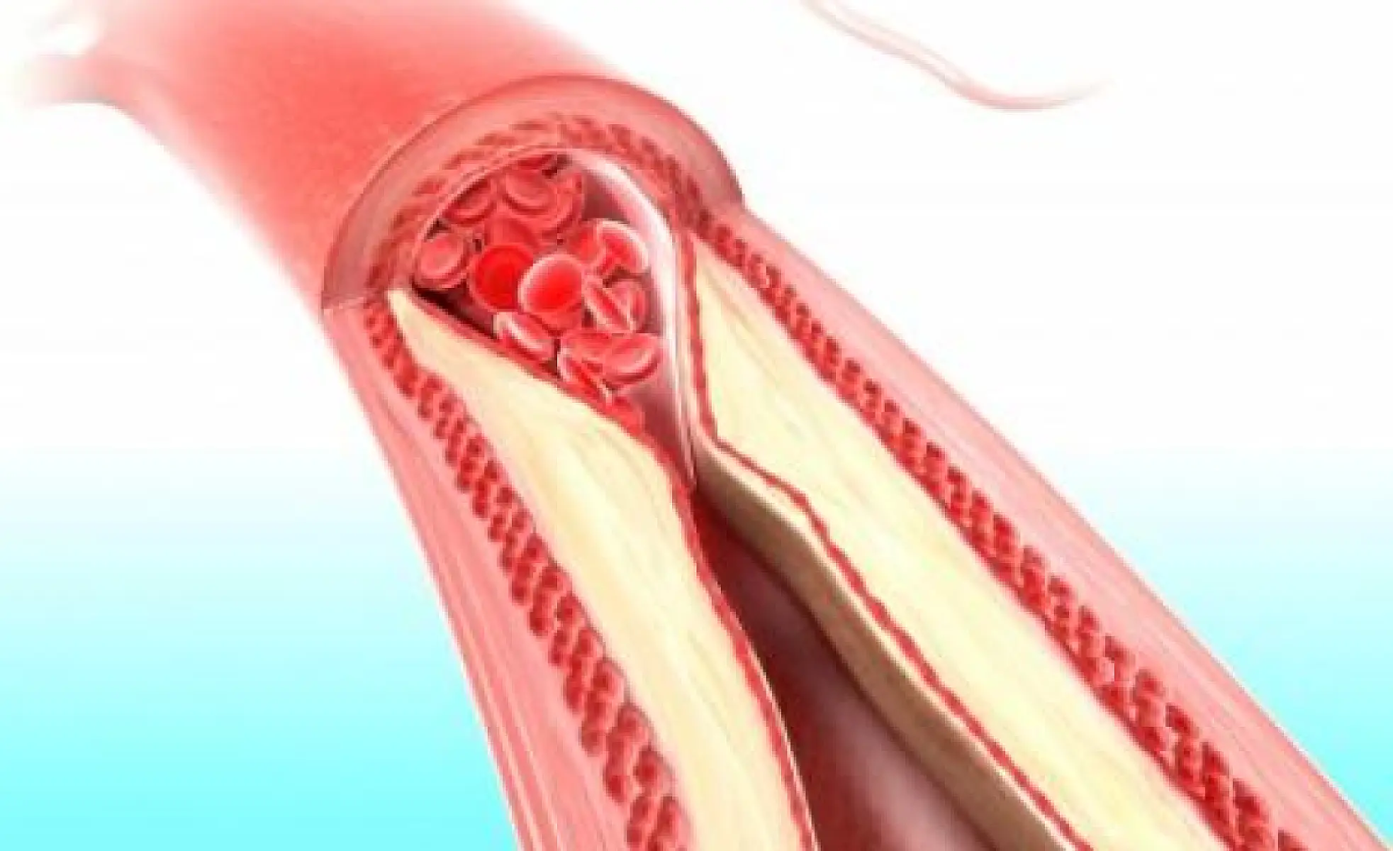 How to Clean Your Arteries With One Simple Fruit
