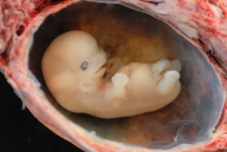 Sick And Twisted: Human-Animal Hybrids Are Being Created In Labs All Over The Planet