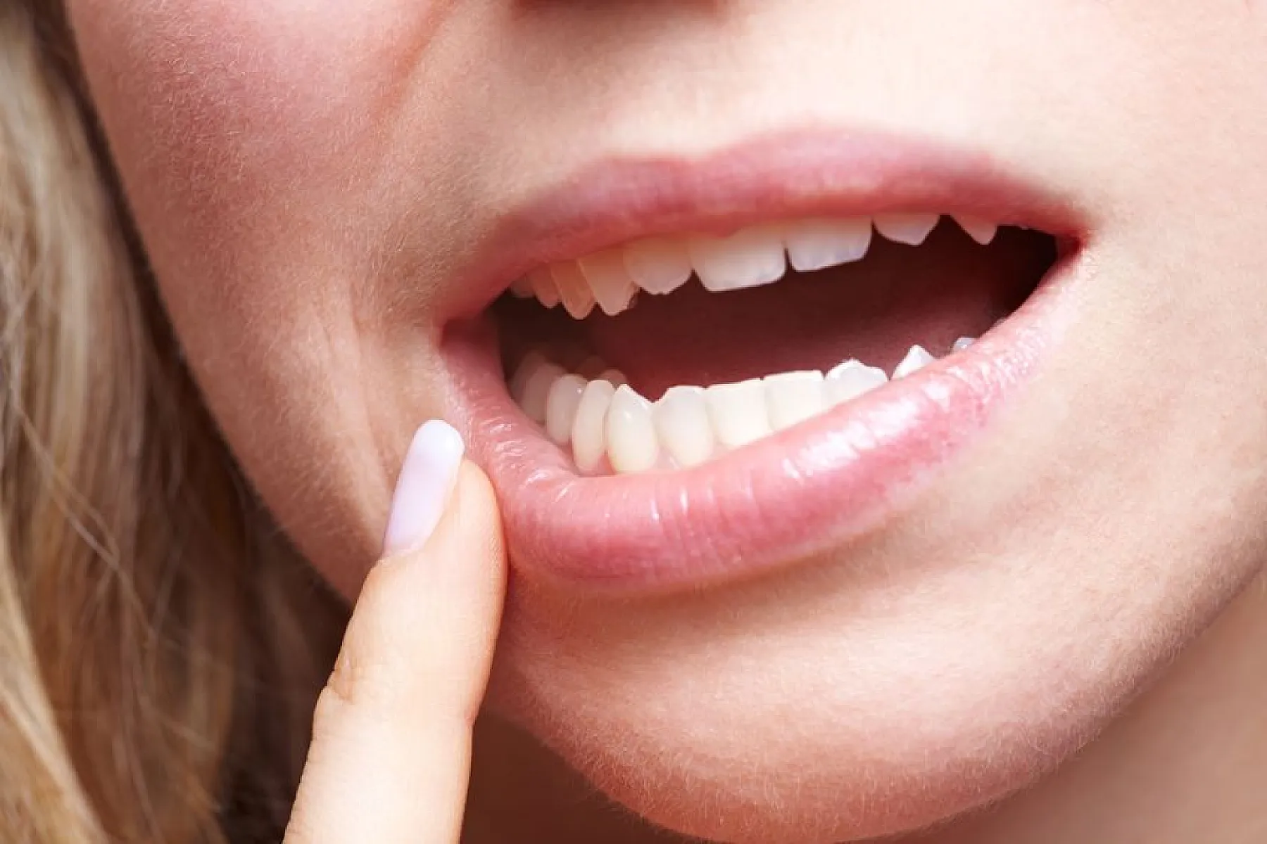 Turmeric Superior to Chemical Mouthwash In Improving Oral Health