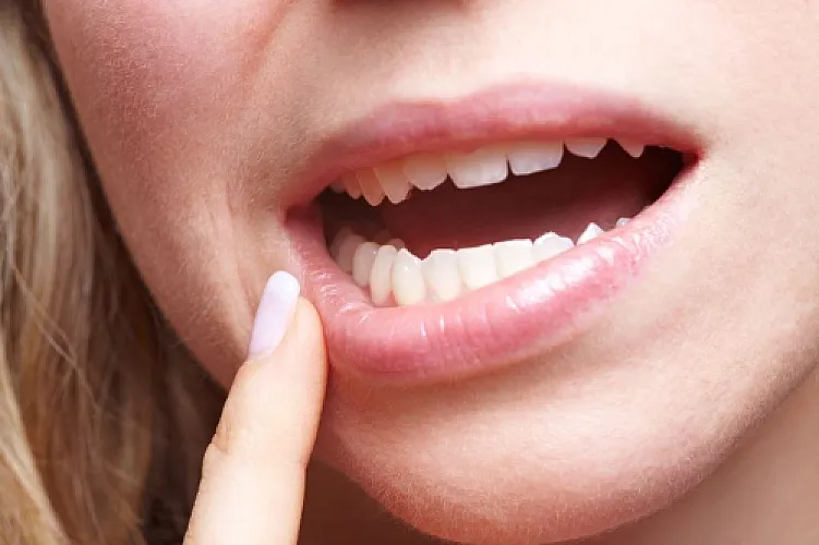 Turmeric Superior to Chemical Mouthwash In Improving Oral Health