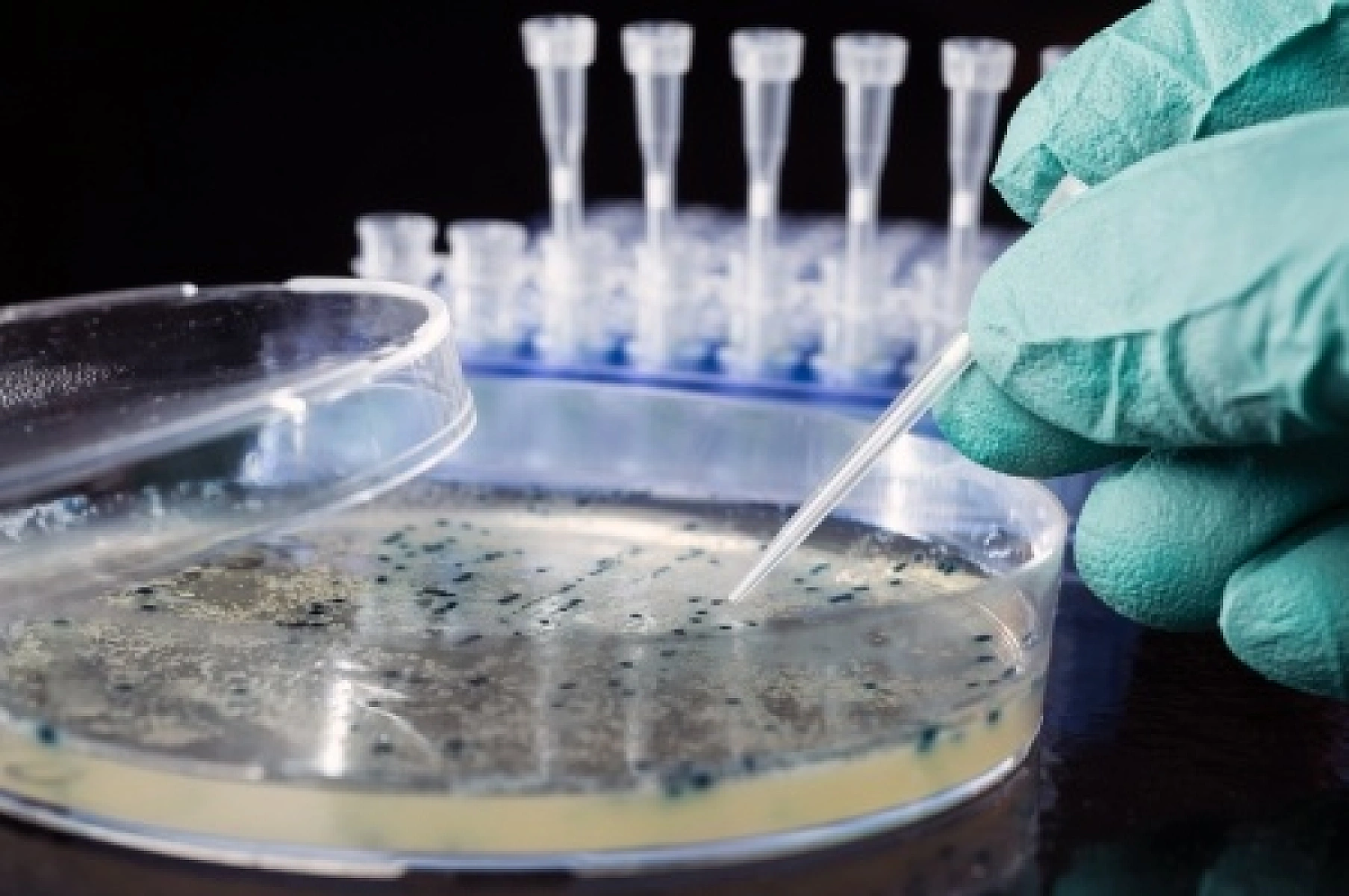 Aspartame: Genetically Modified Bacterial Excretions in Your Food And Drink