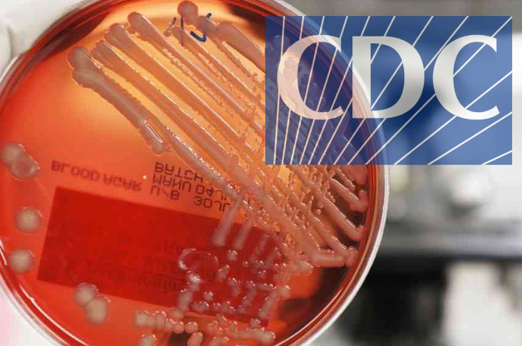 CDC's 'Bacteria of Nightmares': A Monstrosity Created by Outdated Theory and Practice