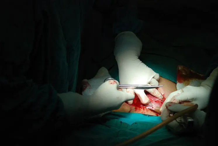 Am Journal of ObGYN's Anti-Homebirth Campaign Sacrifices Lives of 100 US Women Per Year