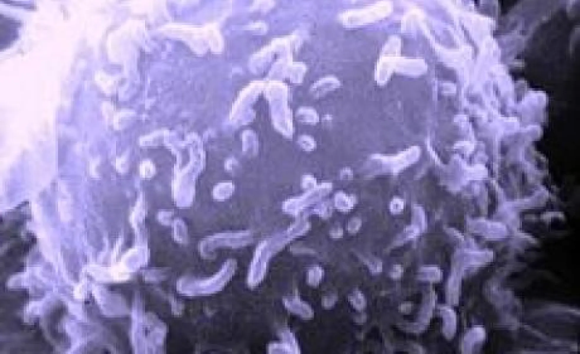 Is Cancer An Ancient Survival Program Unmasked?