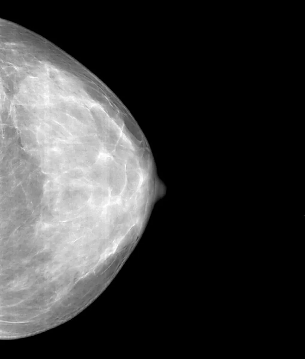Mammogram Alternatives Can Also Be Dangerous (And Often Are) 