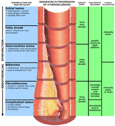 Dietary flaxseed is a valuable strategy to accelerate the regression of atherosclerotic plaques
