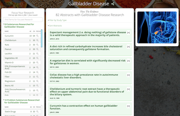 Gallbladder Disease