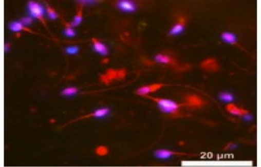 Is This Ubiquitous Toxic Metal Lowering Men's Sperm Counts?