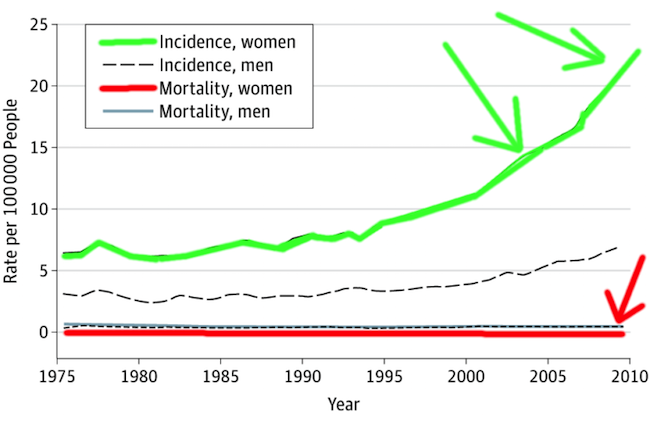 Alum Jax Cole Thyroid Cancer Epidemic of Overdiagnosis