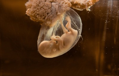 Breaking Water Balloons and Amniotic Sacs