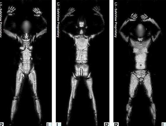 Backscanner Images