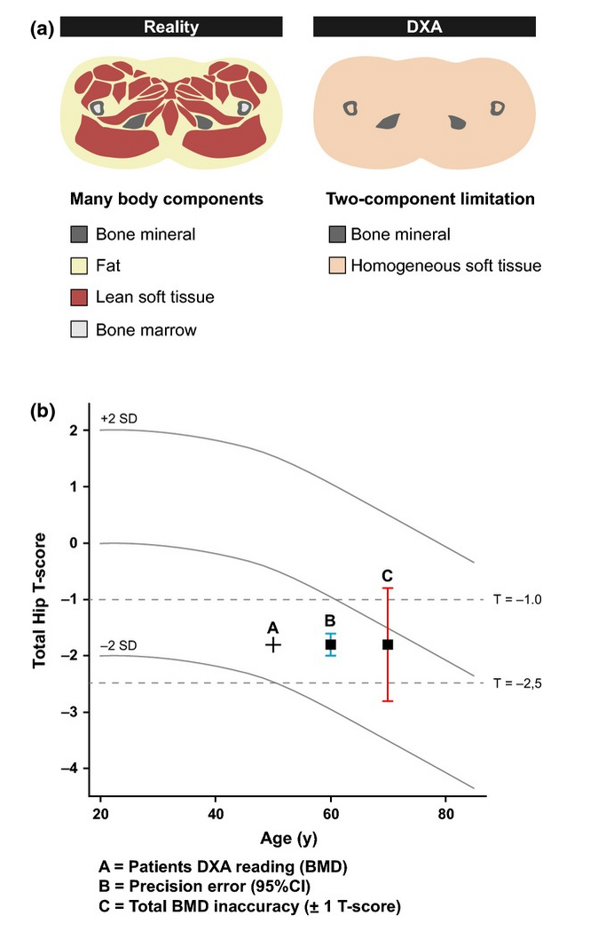 Bone Density