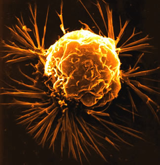 Breast Cancer Proliferation
