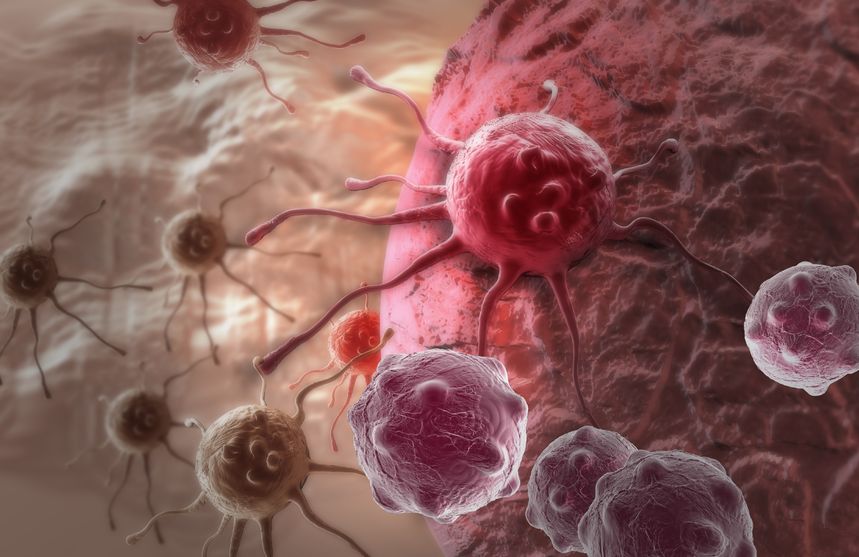Cancer as a Metabolic Disease