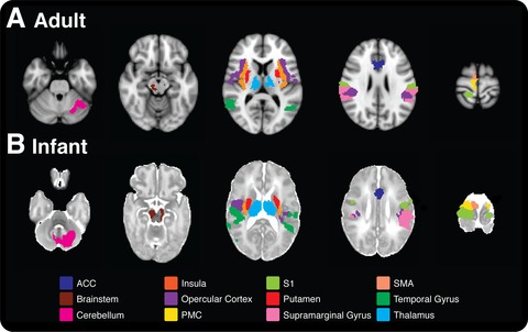 brain scans