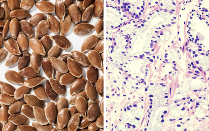 3 Foods That Look Like the Organ They Heal