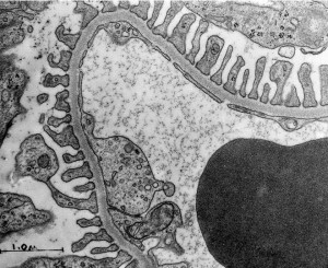 glomerular capillary membrane