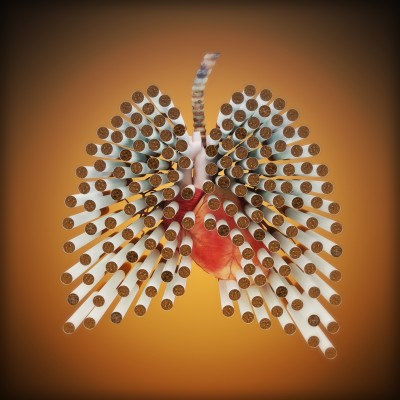 Lung Cancer Tobacco Polonium 210