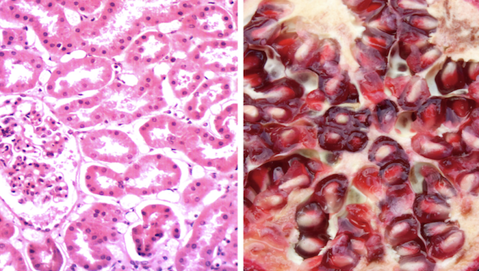 3 Foods That Look Like the Organ They Heal