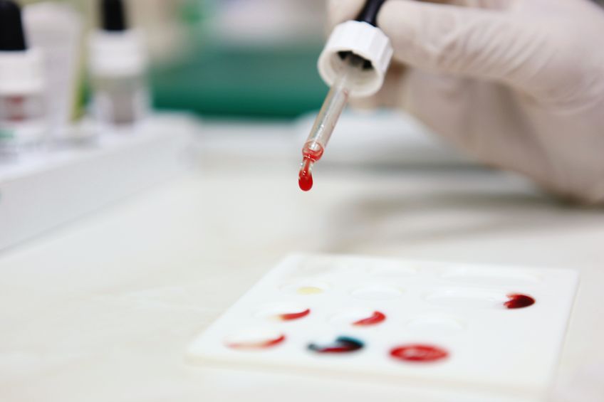 The Failed Medical Experiment: PSA Screening for Prostate Cancer