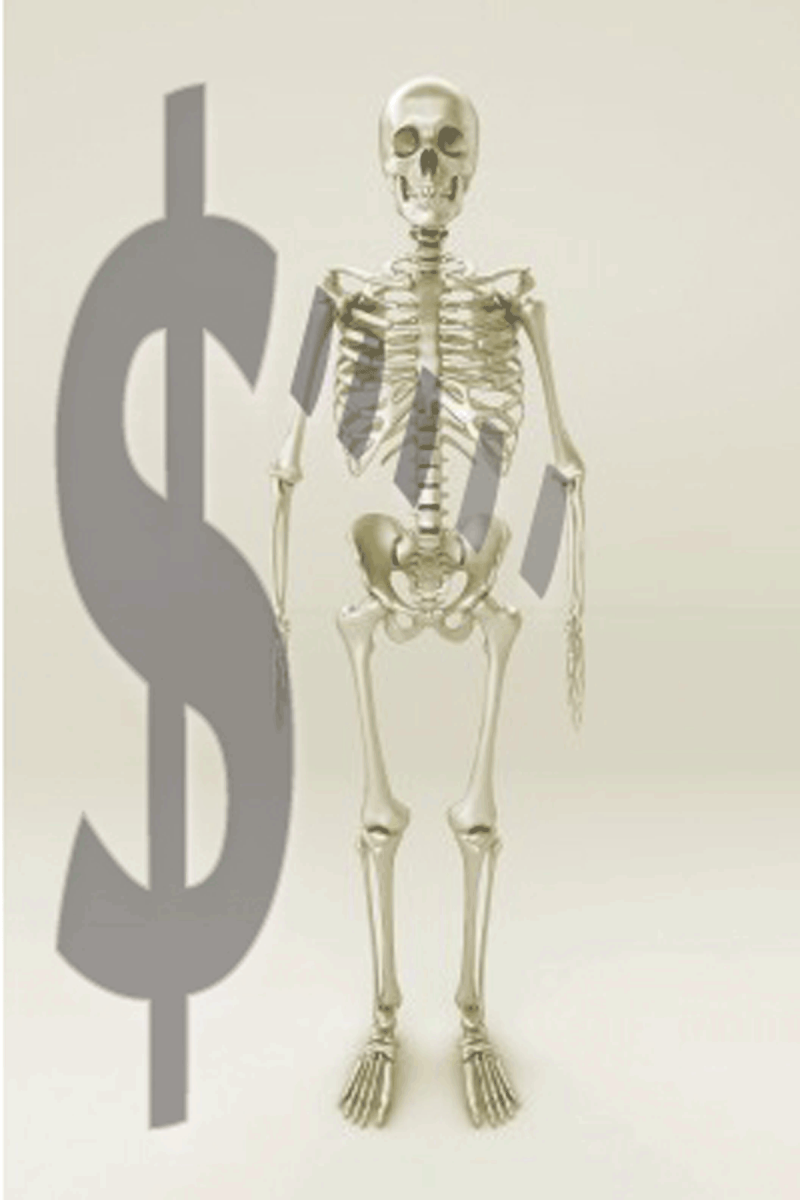 Bone Scans or Scams? How Dense Bones Can Harm Your Health