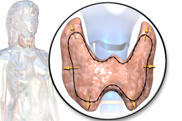 7 Reasons Your Thyroid Medication Isn't Working