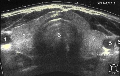Description: hyroid sonogram jeffrey dach md